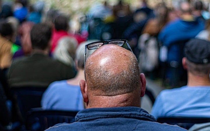 Trasplante capilar ¿Es un método eficaz para recuperar el cabello?